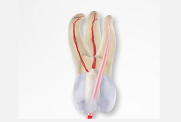 Endodontics