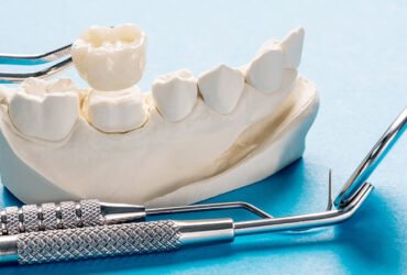 Prosthodontics (Fixed & Removable)